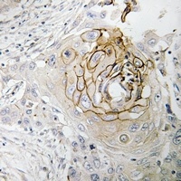 Nav1.7 Rabbit Polyclonal Antibody
