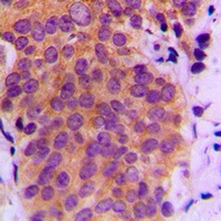 MKK4 (Phospho-S80) Rabbit Polyclonal Antibody