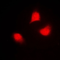 MKK4 (Phospho-T261) Antibody