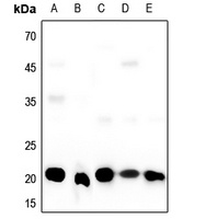 SRSF3 Rabbit Polyclonal Antibody