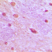 SRSF3 Rabbit Polyclonal Antibody