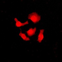 SRSF3 Rabbit Polyclonal Antibody