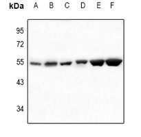 SGK1/2 Rabbit Polyclonal Antibody