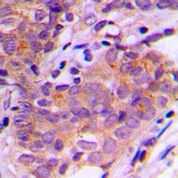 SGK1/2 Rabbit Polyclonal Antibody