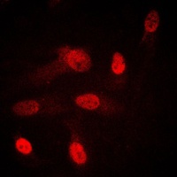 SGK1/2 Rabbit Polyclonal Antibody
