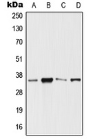 SIX3 Rabbit Polyclonal Antibody