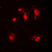 SKP2 Antibody