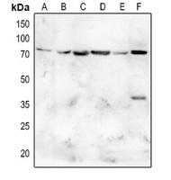 SGLT2 Rabbit Polyclonal Antibody