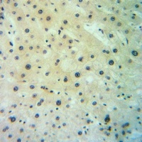 SGLT2 Rabbit Polyclonal Antibody
