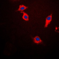 Beta-synuclein Rabbit Polyclonal Antibody