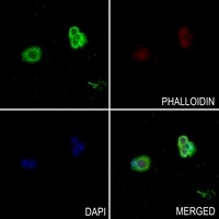 SNX1 Rabbit Polyclonal Antibody