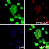 SOD1 Rabbit Polyclonal Antibody