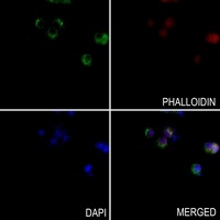 SOX11 Rabbit Polyclonal Antibody