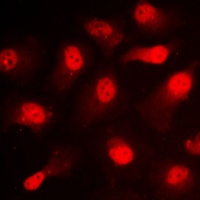 STAT1 (Phospho-S727) Antibody