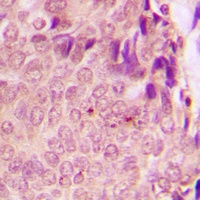 STAT3 (Phospho-S727) Rabbit Polyclonal Antibody