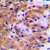 STAT5A (Phospho-S780) Antibody