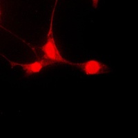 STAT5A (Phospho-S780) Antibody