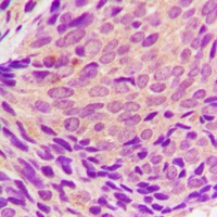 SYK (Phospho-Y323) Antibody