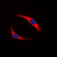 SYK (Phospho-Y323) Antibody