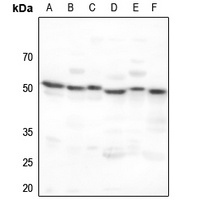 ADA2A Rabbit Polyclonal Antibody