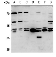 TCF7 Rabbit Polyclonal Antibody