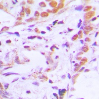 TCF7 Rabbit Polyclonal Antibody