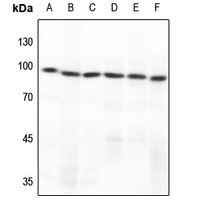GCFC2 Rabbit Polyclonal Antibody