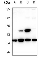 TCF19 Rabbit Polyclonal Antibody