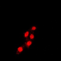 TEAD1 Antibody