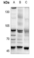 AP2 alpha/beta Antibody