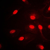 AP2 alpha/beta Antibody