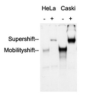 AP2 alpha/beta Antibody
