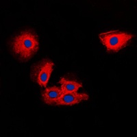 TIMP2 Rabbit Polyclonal Antibody