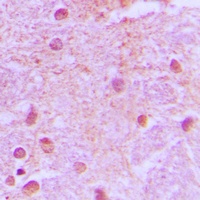TLE4 Rabbit Polyclonal Antibody