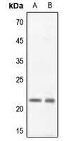 Claudin 5 Rabbit Polyclonal Antibody