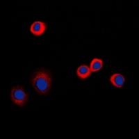 CD120b Rabbit Polyclonal Antibody