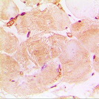 cTnI Rabbit Polyclonal Antibody