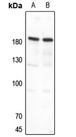 Topoisomerase 2 alpha Rabbit Polyclonal Antibody