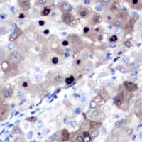 Topoisomerase 2 alpha Rabbit Polyclonal Antibody