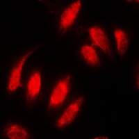 Topoisomerase 2 alpha Rabbit Polyclonal Antibody