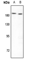 Topoisomerase 2 beta Rabbit Polyclonal Antibody