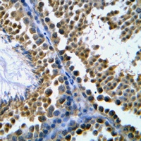 Topoisomerase 2 beta Rabbit Polyclonal Antibody