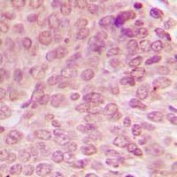 p53 (Phospho-S15) Antibody