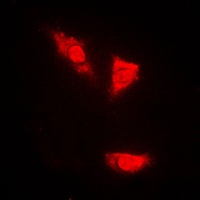 p53 (Phospho-S15) Antibody