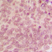 p53 (Phospho-S315) Antibody