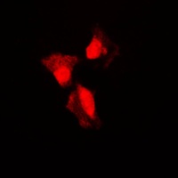p53 (Phospho-S315) Antibody