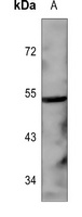p53 Rabbit Polyclonal Antibody