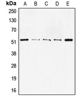 p53 Rabbit Polyclonal Antibody