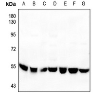 p53 Rabbit Polyclonal Antibody