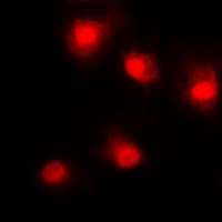 p53 Rabbit Polyclonal Antibody